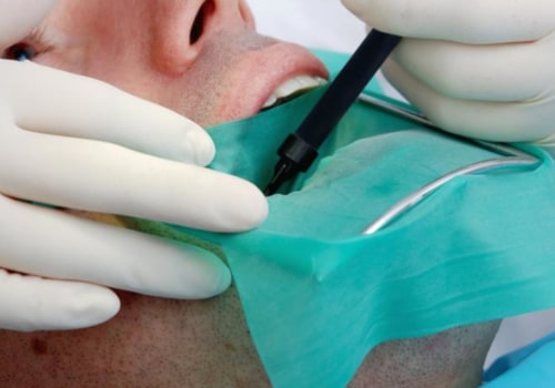 Why do only some dentists do root canals?